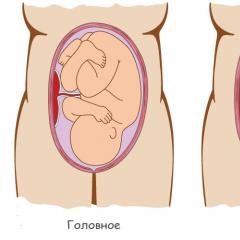 Ang posisyon ng pelvic ng fetus: mga dahilan, mga karapatan para sa pagbaliktad at mga kakaiba ng mga canopies